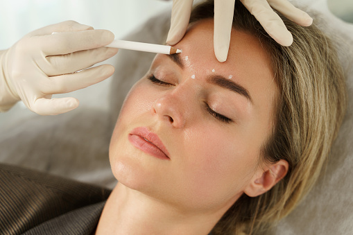 Faltenbehandlung mit Botulinumtoxin A – ästhetische Medizin in der HNO-Praxis Dr. Schrader
